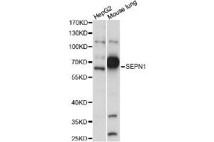 Western blot analysis of extracts of various cell lines, using SEPN1 antibody (ABIN6289941) at 1:1000 dilution. (Selenoprotein N antibody)