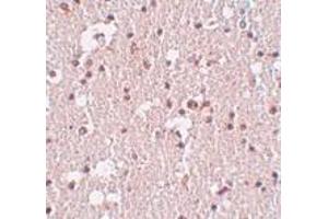 Immunohistochemistry of FRMPD3 in human brain tissue with FRMPD3 antibody at 5 μg/ml. (FRMPD3 antibody  (Center))