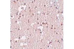 Immunohistochemistry of FRMPD3 in human brain tissue with FRMPD3 antibody at 5 μg/ml.
