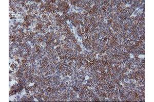 Immunohistochemistry (IHC) image for anti-T-cell surface glycoprotein CD1c (CD1C) antibody (ABIN1497187) (CD1c antibody)