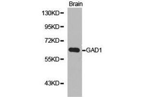 Western Blotting (WB) image for anti-Glutamate Decarboxylase 1 (Brain, 67kDa) (GAD1) antibody (ABIN1872765) (GAD antibody)