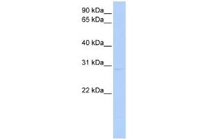 WB Suggested Anti-KCNIP2 Antibody Titration:  0. (KCNIP2 antibody  (N-Term))