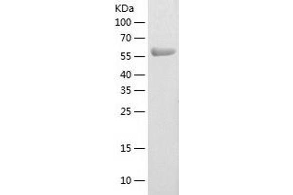 WHSC2 Protein (AA 1-539) (His tag)