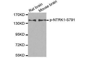 Western blot analysis of extracts from rat and mouse brain tissue using Phospho-NTRK1-S791 antibody (ABIN2987788).