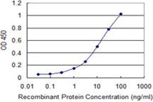 Detection limit for recombinant GST tagged ISL1 is 0. (ISL1 antibody  (AA 63-159))