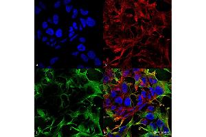 Immunocytochemistry/Immunofluorescence analysis using Mouse Anti-Neuroligin 3 Monoclonal Antibody, Clone S110-29 . (Neuroligin 3 antibody  (AA 730-848) (Atto 488))