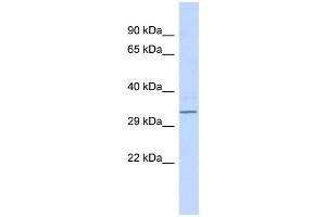 WB Suggested Anti-RFPL4B Antibody Titration:  0. (RFPL4B antibody  (Middle Region))