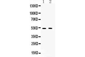Western blot analysis of CHRM2 expression in rat brain extract ( Lane 1) and mouse brain extract ( Lane 2). (Muscarinic Acetylcholine Receptor M2 antibody  (C-Term))