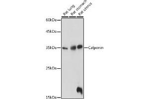 Western blot analysis of extracts of various cell lines, using Calponin antibody (ABIN7266040) at 1:1000 dilution. (CNN1 antibody  (AA 130-180))