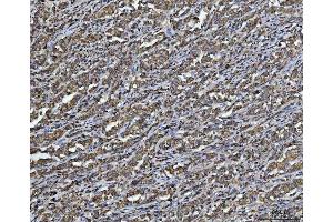 IHC analysis of ARL13B using anti-ARL13B antibody (ABIN7600179). (ARL13B antibody  (AA 16-428))