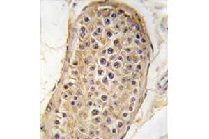 Formalin-fixed and paraffin-embedded human testis tissue reacted with RICTOR antibody (N-term) , which was peroxidase-conjugated to the secondary antibody, followed by DAB staining. (RICTOR antibody  (N-Term))