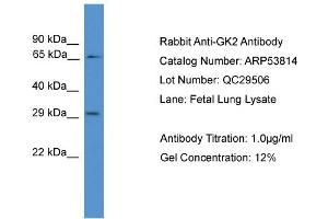 WB Suggested Anti-GK2  Antibody Titration: 0.