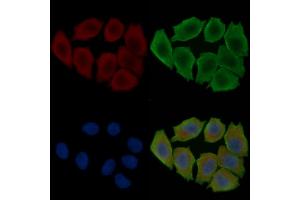 ABIN6263901 and ABIN6278065 staining Hela cells(30 min of UV treatment) by IF/ICC. (ORAI1 antibody  (C-Term))