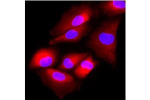 Immunofluorescence (IF) image for anti-N-Acetyltransferase 6 (GCN5-Related) (NAT6) (AA 1-308), (N-Term) antibody (ABIN452458) (NAT6 antibody  (N-Term))