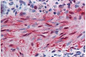 Human Colon, muscularis mucosa: Formalin-Fixed, Paraffin-Embedded (FFPE) (YAP1 antibody  (AA 53-162))