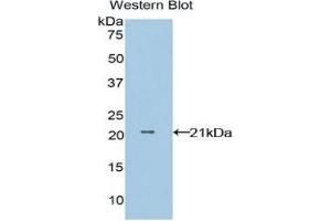 Western Blotting (WB) image for anti-Non-Metastatic Cells 1, Protein (NM23A) Expressed in (NME1) (AA 1-152) antibody (ABIN3202548) (NME1 antibody  (AA 1-152))
