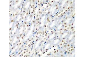 Immunohistochemistry of paraffin-embedded Mouse kidney using SF3B3 Polyclonal Antibody at dilution of 1:200 (40x lens). (SF3B3 antibody)