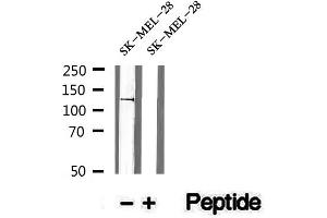 Western blot analysis of extracts of SK-MEL-28 cells, using Phospho-NEDD4L (Ser448) Antibody.