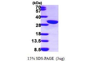 SDS-PAGE (SDS) image for Calbindin 2 (CALB2) (AA 1-271) protein (His tag) (ABIN667199)