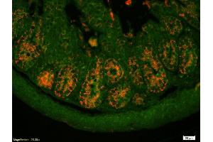 Formalin-fixed and paraffin-embedded mouse intestine labeled with Anti-PAI1/PLANH1/Serpine 1 Polyclonal Antibody, Unconjugated (ABIN718106) 1:200, overnight at 4°C, The secondary antibody was Goat Anti-Rabbit IgG, Cy3 conjugated used at 1:200 dilution for 40 minutes at 37°C. (PAI1 antibody  (AA 251-350))