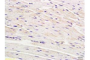 Formalin-fixed and paraffin embedded rat myocardium tissue labeled with Anti-Connexin-40 Polyclonal Antibody, Unconjugated  at 1:200, followed by conjugation to the secondary antibody and DAB staining