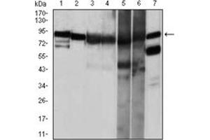 Western Blotting (WB) image for anti-Heat Shock Protein 90kDa alpha (Cytosolic), Class A Member 1 (HSP90AA1) antibody (ABIN1107606)