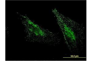 Immunofluorescence of monoclonal antibody to MBTPS1 on HeLa cell. (MBTPS1 antibody  (AA 246-355))