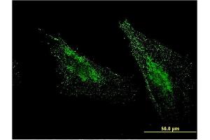 Immunofluorescence of monoclonal antibody to MBTPS1 on HeLa cell.