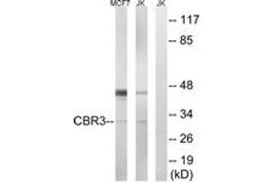 Western blot analysis of extracts from Jurkat/MCF7 cells, using CBR3 Antibody. (CBR3 antibody  (AA 151-200))