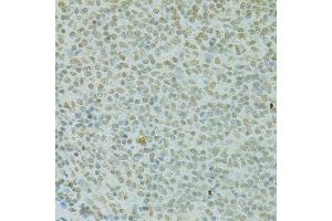 Immunohistochemistry (Paraffin-embedded Sections) (IHC (p)) image for anti-Regulator of Chromosome Condensation 1 (RCC1) (AA 1-240) antibody (ABIN6146817)