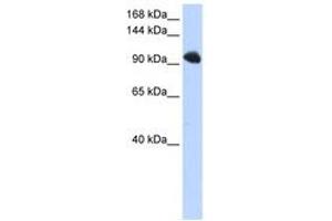 Image no. 1 for anti-Splicing Factor, Suppressor of White-Apricot Homolog (SFSWAP) (AA 36-85) antibody (ABIN6740677) (SFRS8 antibody  (AA 36-85))