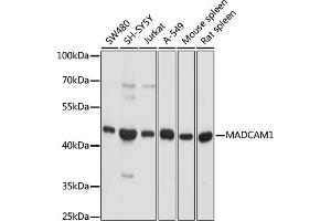 Western blot analysis of extracts of various cell lines, using M antibody (ABIN3017162, ABIN3017163, ABIN3017164, ABIN1680735 and ABIN1680736) at 1:1000 dilution. (MADCAM1 antibody)