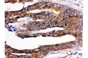 Immunohistochemistry (Paraffin-embedded Sections) (IHC (p)) image for anti-UPF1 Regulator of Nonsense Transcripts Homolog (UPF1) (AA 578-614), (Middle Region) antibody (ABIN3043955) (RENT1/UPF1 antibody  (Middle Region))
