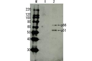 Western Blotting (WB) image for anti-HIV-1 Reverse Transcriptase (HIV1RT) (full length) antibody (ABIN2452030)
