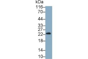 Detection of IFNg in Cavia Testis lysate using Monoclonal Antibody to Interferon Gamma (IFNg) (Interferon gamma antibody  (AA 24-166))