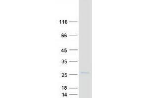 Validation with Western Blot (TMEM11 Protein (Transcript Variant 1) (Myc-DYKDDDDK Tag))