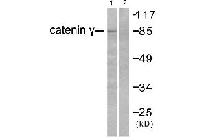 Western blot analysis of extracts from HeLa cells, using Catenin-γ antibody. (JUP antibody)