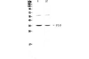Western blot analysis of IL12A using anti-IL12A antibody . (IL12A antibody  (AA 23-215))