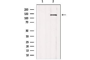 AGTPBP1 antibody  (Internal Region)