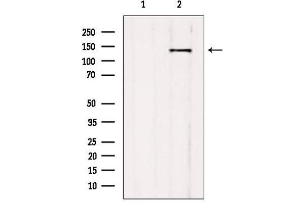 AGTPBP1 antibody  (Internal Region)