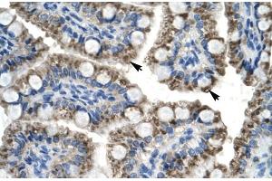Rabbit Anti-C20orf100 Antibody Catalog Number: ARP30008 Paraffin Embedded Tissue: Human Intestine Cellular Data: Epithelial cells of intestinal villas Antibody Concentration: 4. (TOX2 antibody  (N-Term))