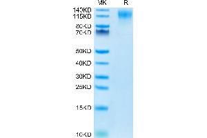 Mouse CD96 on Tris-Bis PAGE under reduced condition. (CD96 Protein (CD96) (AA 22-536) (His tag))