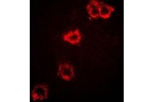 Immunofluorescent analysis of STS-1 staining in SKOV3 cells. (UBASH3B antibody)