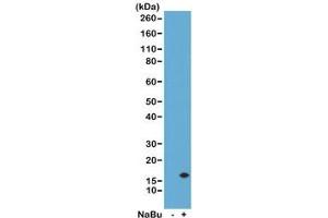 Western Blot of acid extracts from human HeLa cells untreated (-) or treated (+) with sodium butyrate using the recombinant H3K14ac antibody at 0.