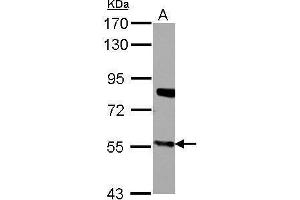 WB Image Sample (30 ug of whole cell lysate) A: A549 7. (CYP27A1 antibody  (Center))
