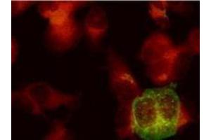Immunofluorescence (IF) image for anti-Herpes Simplex Virus Type 2, Glycoprotein E (HSV2 gE) antibody (ABIN265568)