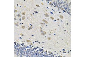 Immunohistochemistry of paraffin-embedded rat brain using ITGA2 Antibody. (ITGA2 antibody)