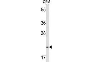 Western blot analysis of TIFA Antibody (N-term) in CEM cell line lysates (35 µg/lane). (TIFA antibody  (N-Term))