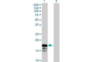 Western Blot analysis of RNF181 expression in transfected 293T cell line by RNF181 MaxPab polyclonal antibody. (RNF181 antibody  (AA 1-153))
