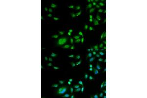 Immunofluorescence analysis of  cells using INTS10 antibody (ABIN6129778, ABIN6142484, ABIN6142486 and ABIN6217410). (INTS10 antibody  (AA 451-710))